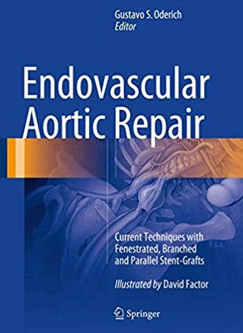 Endovascular Aortic Repair by Gustavo S. Oderich