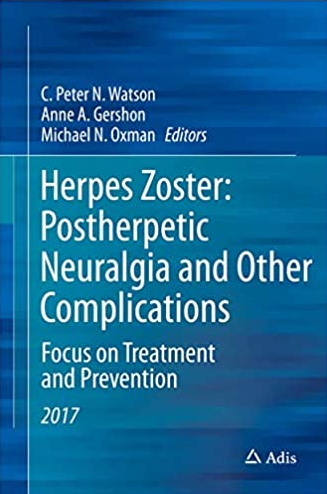 Herpes Zoster