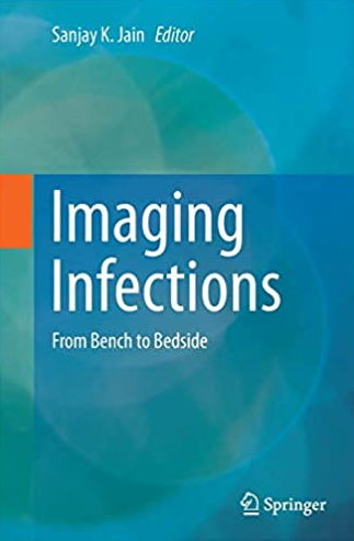Imaging Infections