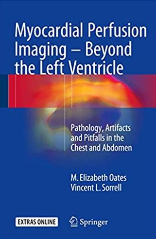 Myocardial Perfusion Imaging – Beyond the Left Ventricle M. Elizabeth Oates