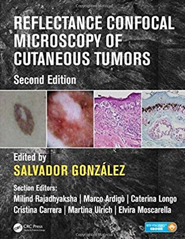 Reflectance Confocal Microscopy of Cutaneous Tumors 2nd Edition
