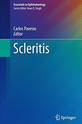 Scleritis (Essentials in Ophthalmology) 2017 Edition Carlos Pavesio