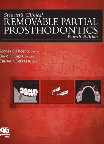 Stewart’s Clinical Removable Partial Prosthodontics 4th Edition Rodney D. Phoenix