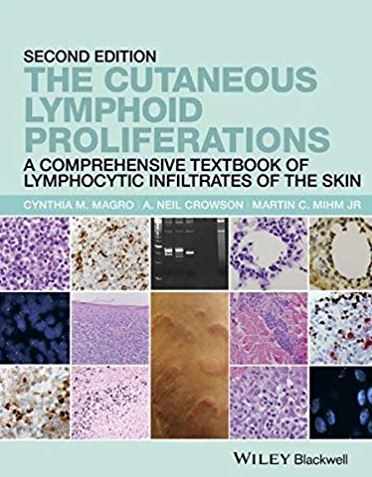 The Cutaneous Lymphoid Proliferations
