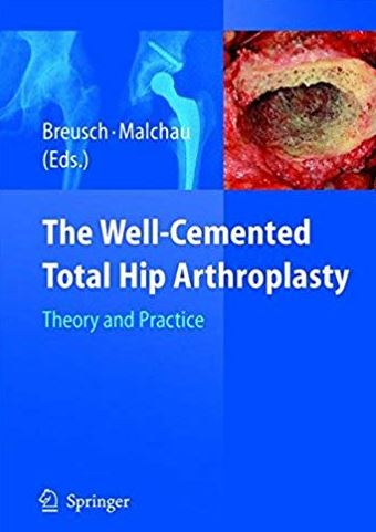 The Well-Cemented Total Hip Arthroplasty