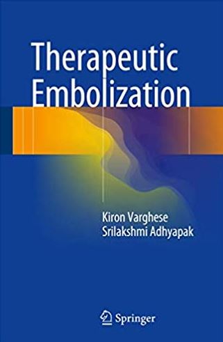 Therapeutic Embolization Kiron Varghese